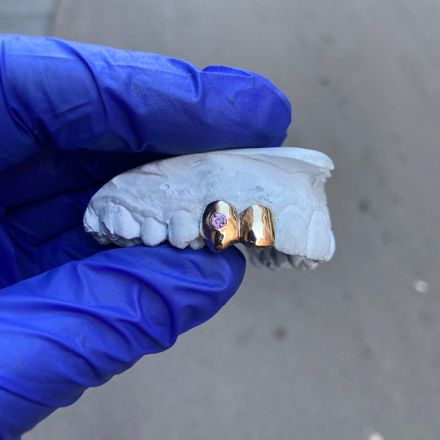 GRILLZ 2 PIEZAS ORO DENTAL + CIRCONITA 💜 AMATISTA 💜