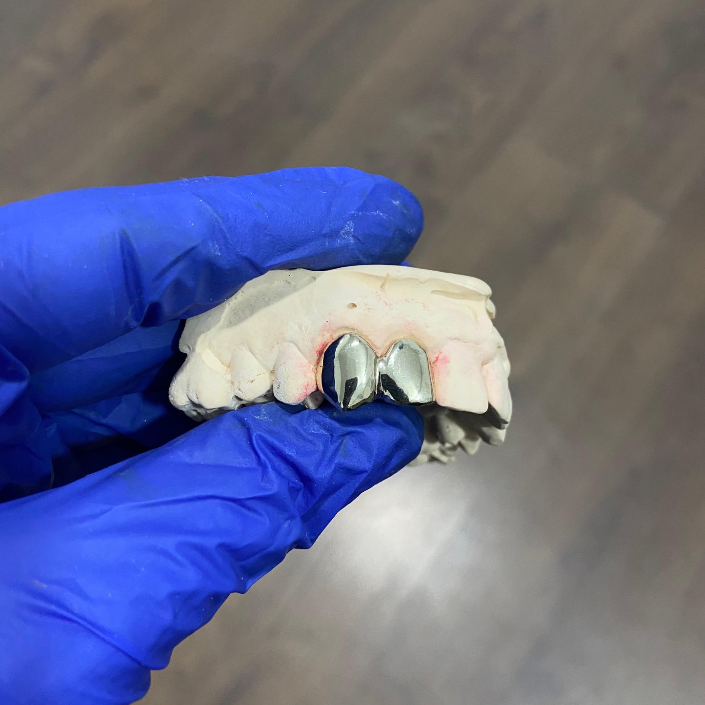 GRILLZ 2 PIEZAS ORO DENTAL