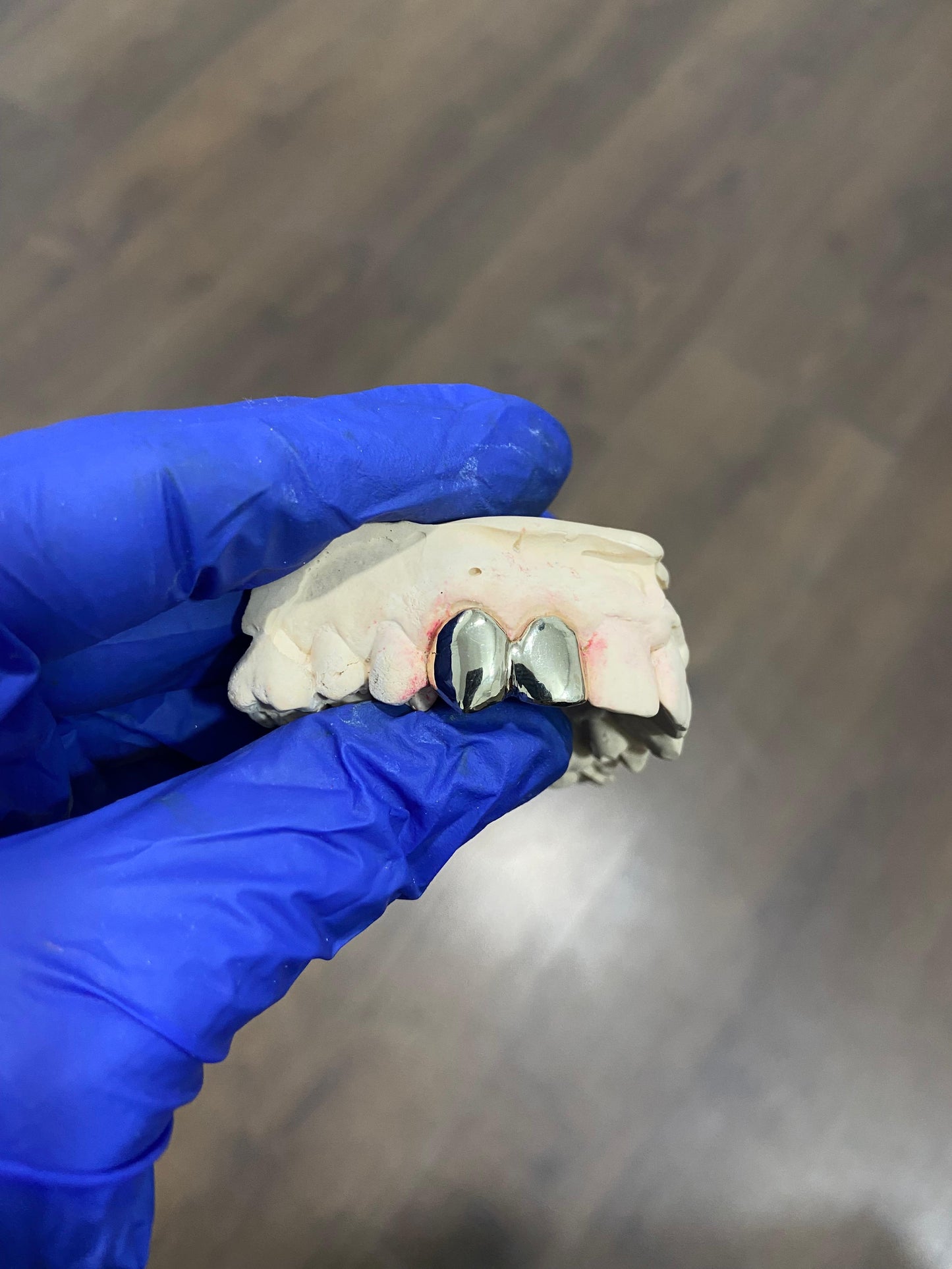 GRILLZ 2 PIEZAS ORO DENTAL